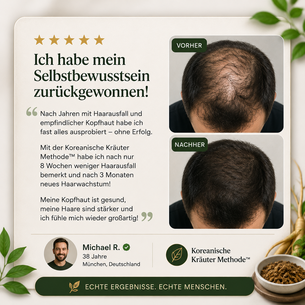 Kundenbewertung — Michael R. mit Vorher/Nachher Vergleich nach 90 Tagen